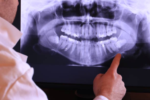 Best Knocked-Out Tooth Emergency  in Makakilo, HI