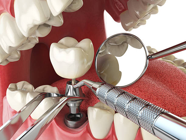 Dentist for Dental Trauma in HI
